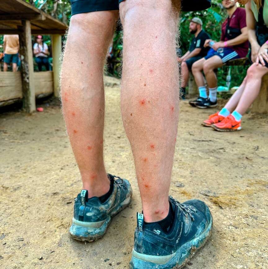 kolumbien stiche sandfliegen