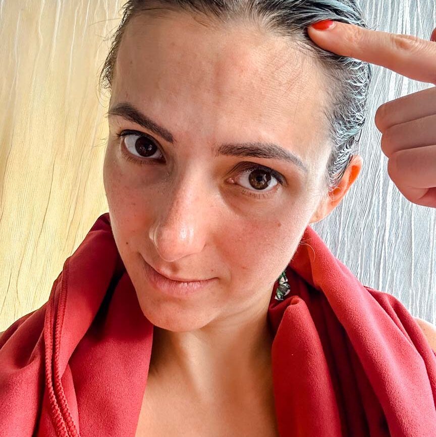 frau mit rotem handtuch und mueckenstich auf dem kopf