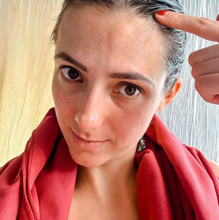 frau mit rotem handtuch und mueckenstich auf dem kopf